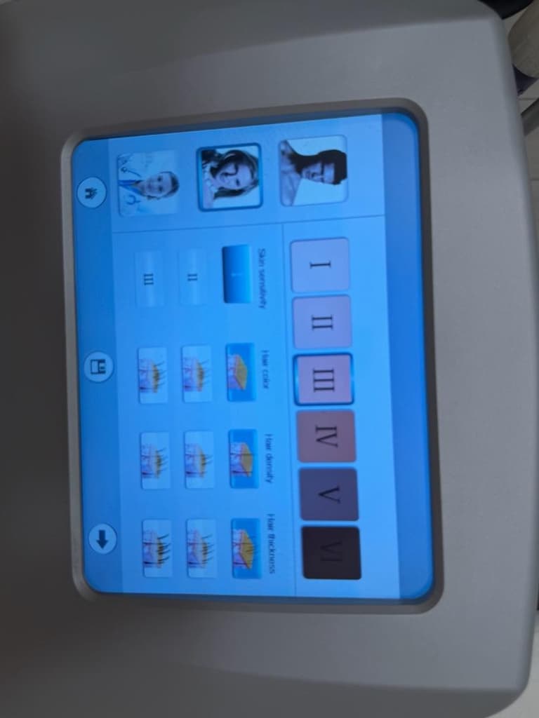 BUZ LAZER EPİLASYON CİHAZI - 4