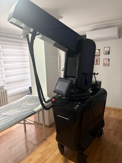 umex lazer