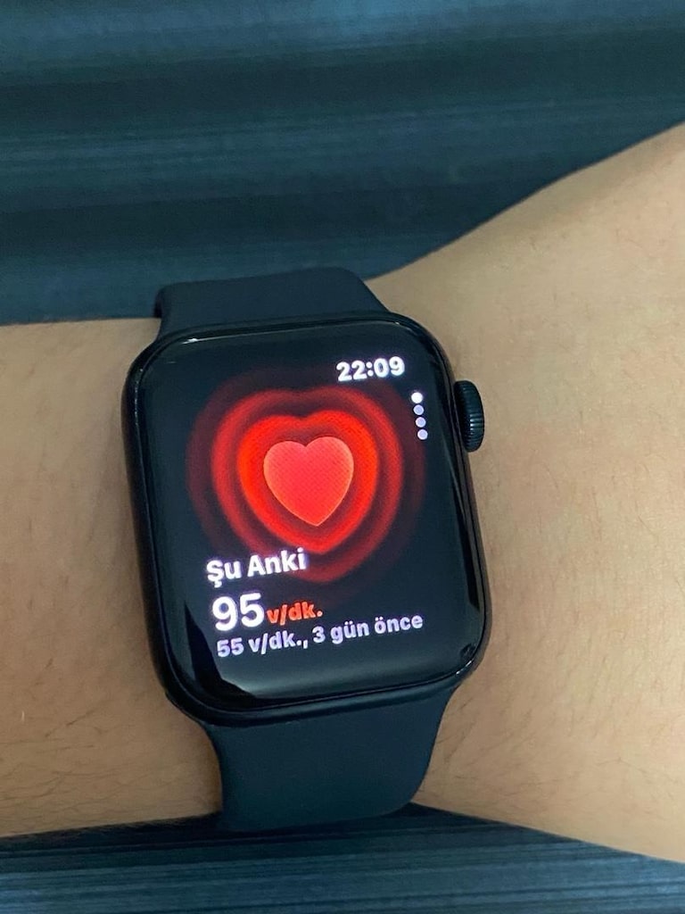 Apple Watch SE 3.nesil - 9