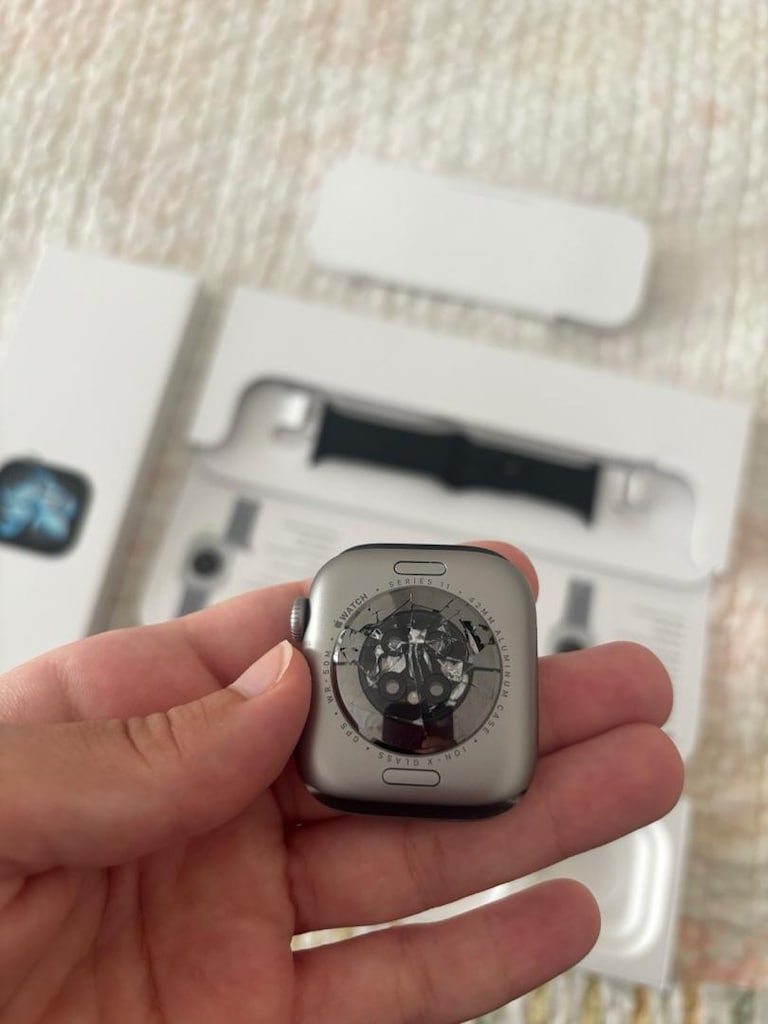 Apple Watch 11 yeni - 3