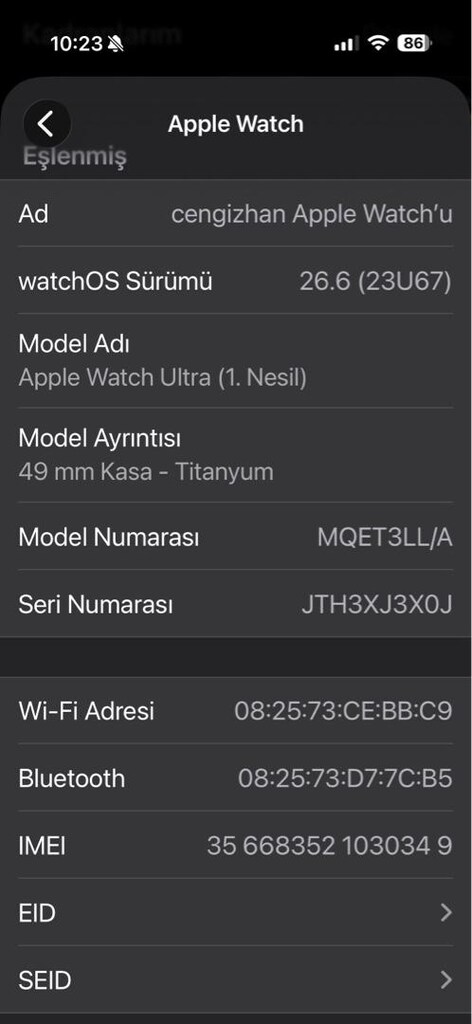apple watch temiz - 3