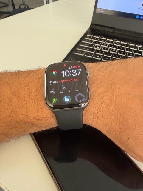 APPLE WATCH SERİES 11 46mm