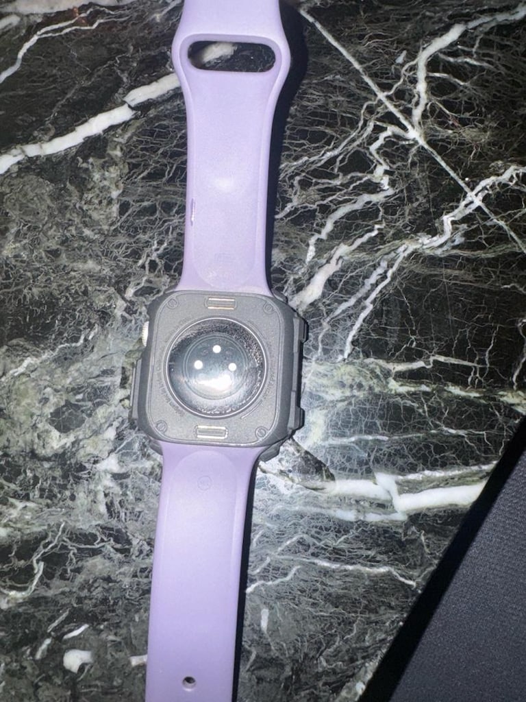 apple watch 11 - 2