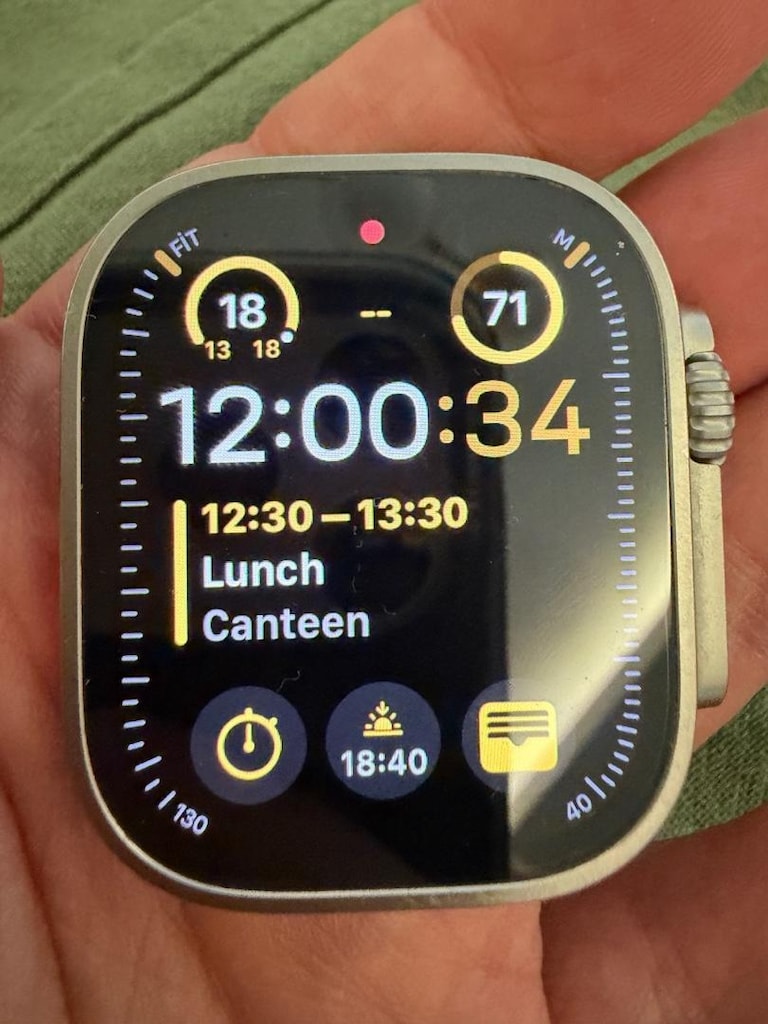 Apple Watch Ultra 2 – %97 Pil – Kutulu + Ekstra Kordonlar - 11