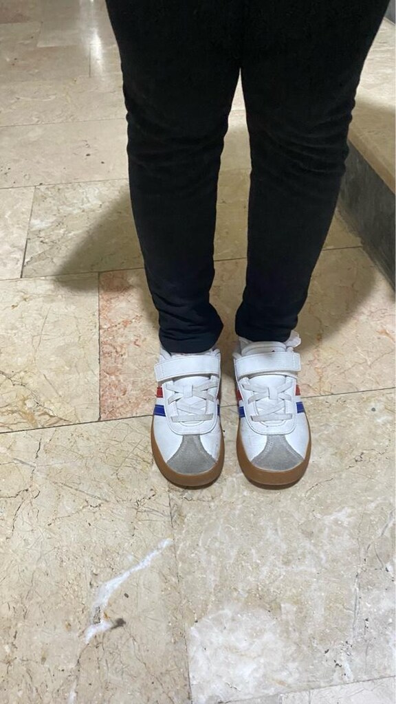 Adidas Orjinal Spor Ayakkabı - 2