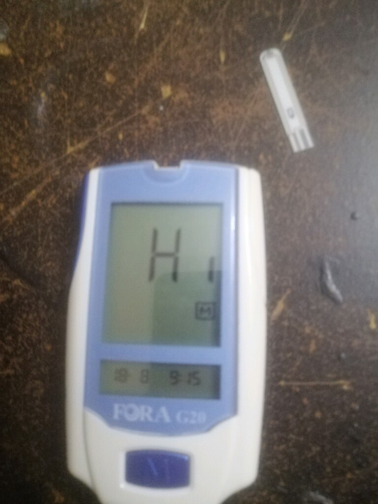 fora basınç. kutulu çubukları var. - 8