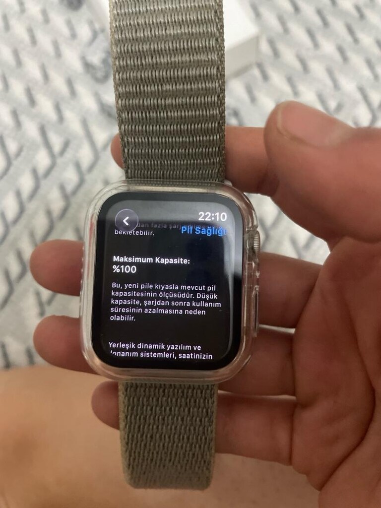 Apple Watch series on - 2