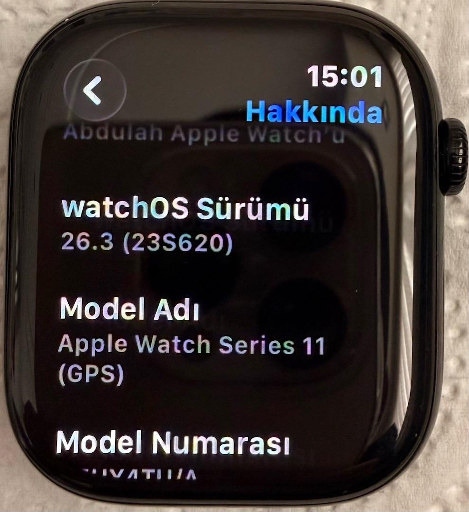 Apple Watch series 11 GPS 46 mm simsiyah - 5