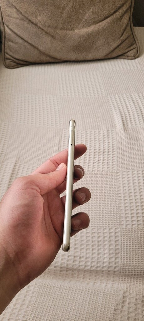 HUAWEİ P10 LİTE TELEFON - 5