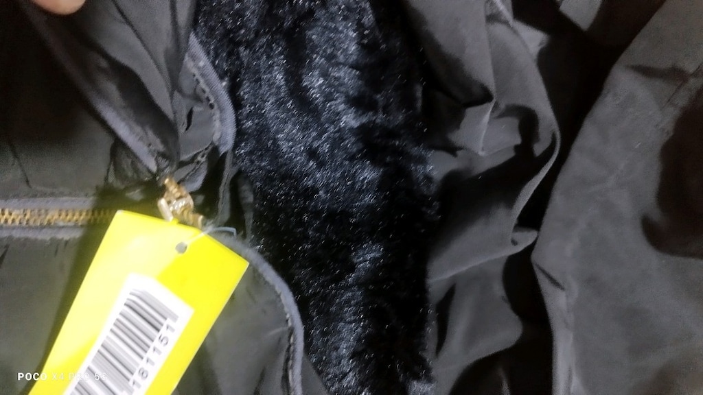 #Zara mont..Beklemekten uçtaki derilerde az soyulma var. - 4