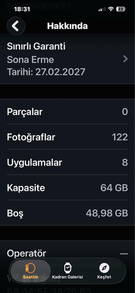 APPLE WATCH ULTRA 3 MİLANO LOOP KORDON - 8